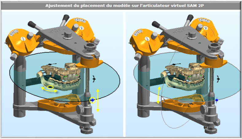  MODELISATION ET REGLAGE DE L’OCCLUSION AVEC L’ARTICULATEUR VIRTUEL