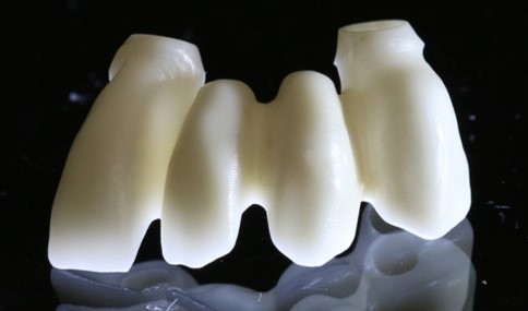 TRANSVISSEES IMPLANTAIRE ZIRCONE     