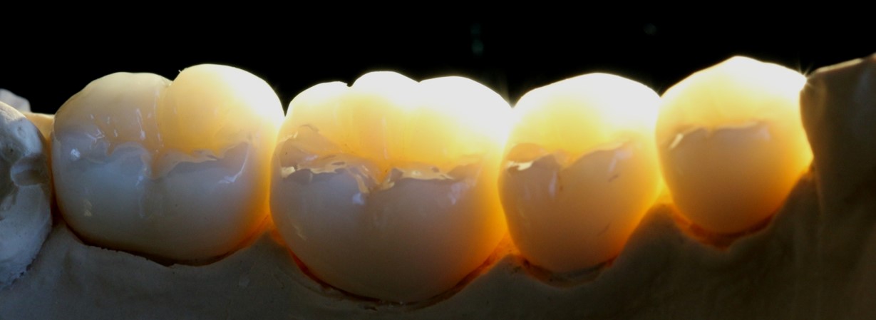 ZIRCONE STRATIFIEES     