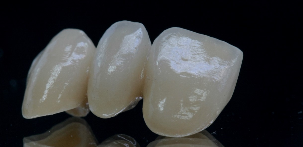 ZIRCONE STRATIFIEES     