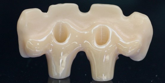 TRANSVISSEES IMPLANTAIRE ZIRCONE     