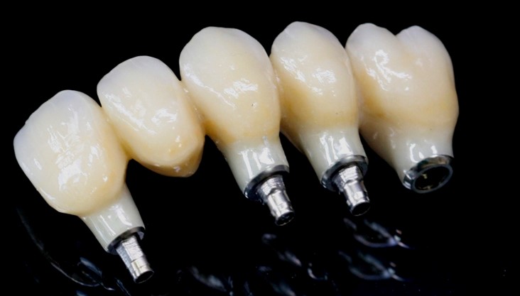 BRIDGE COMPLET TRANSVISSE ZIRCONE