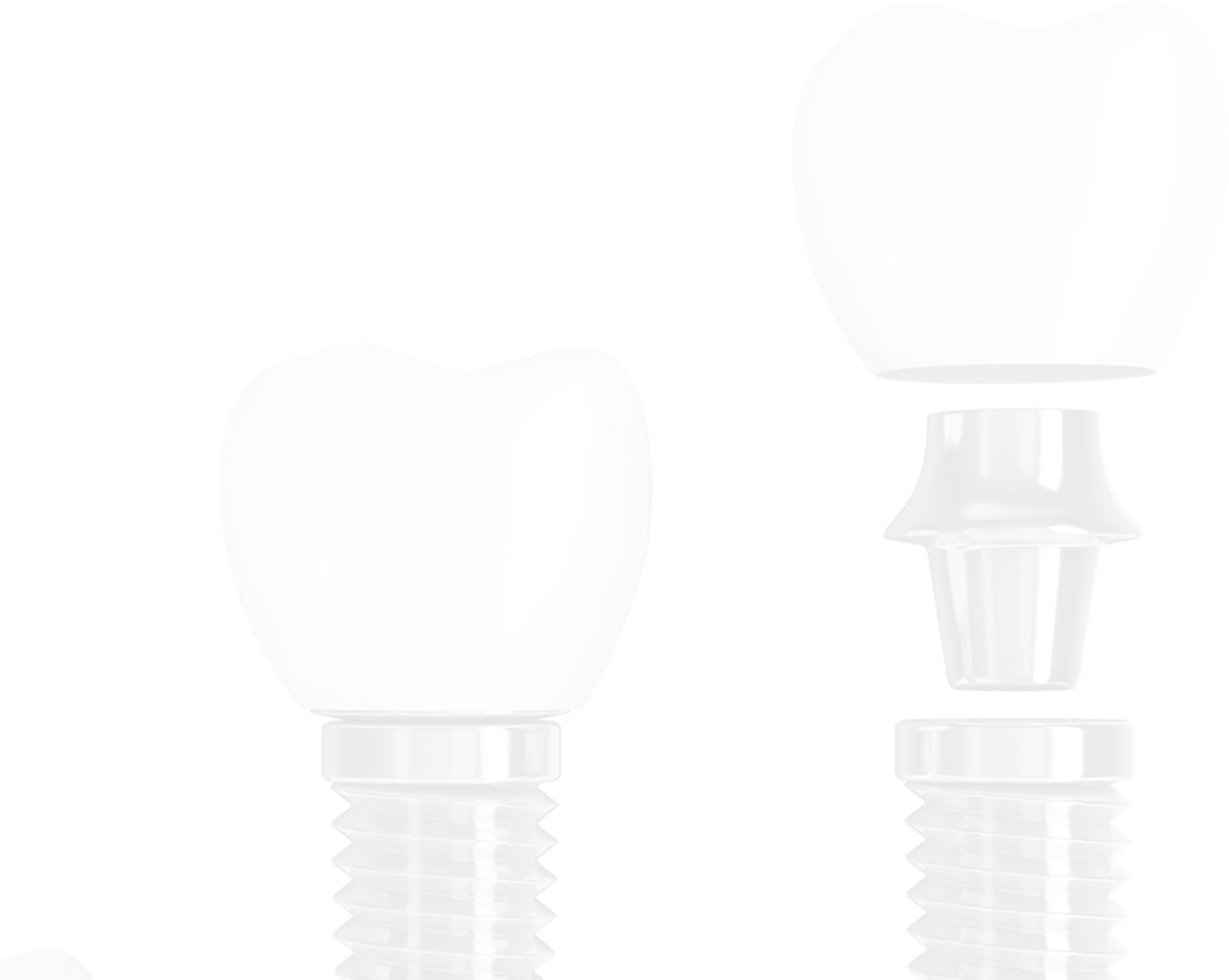 implant