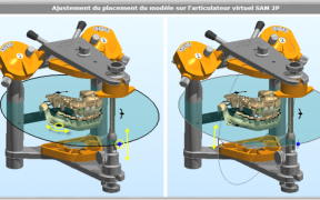  MODELISATION ET REGLAGE DE L’OCCLUSION AVEC L’ARTICULATEUR VIRTUEL