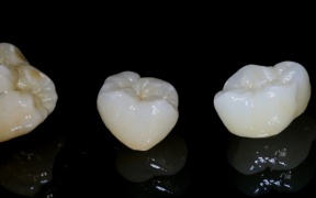 ZIRCONE STRATIFIEES     