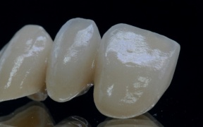 ZIRCONE STRATIFIEES     