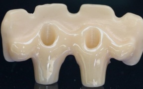 TRANSVISSEES IMPLANTAIRE ZIRCONE     