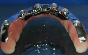 ADJOINTE - PILOTIS METAL ET RESINE