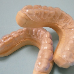 gouttières de blanchiment