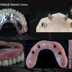 Stellite sur piliers CONUS