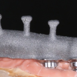 Armature Piloti