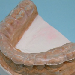 gouttières CNO