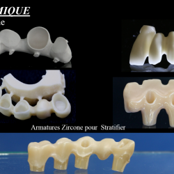 Armatures zircone sinthérisées