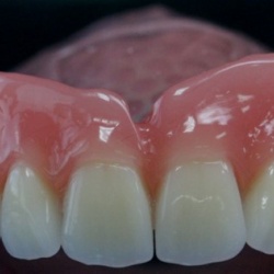 Complet avec grille coulée