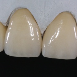 Zircones unitaires