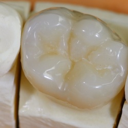 Couronne composite