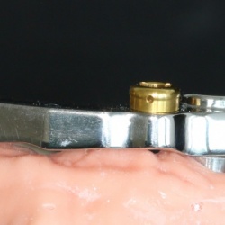 Barre usinée Titane et attachements Locator
