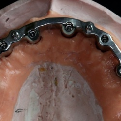 Barre usinée Titane avec O ring 2