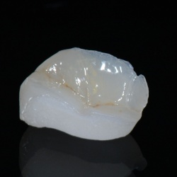 Onlay Emax