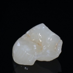 Inlay Emax
